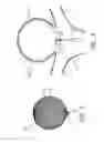 Fig. 04 - Electrolytic detachment for implantable devices