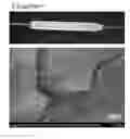 Fig. 01 - DRUG COATED BALLOONS AND TECHNIQUES FOR INCREASING VASCULAR PERMEABILITY