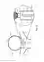 Fig. 09 - Electrolytic detachment with fluid electrical connection