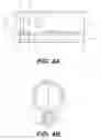 Fig. 04 - Selective tissue removal treatment device