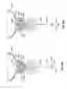 Fig. 93 - Catheter with a double balloon structure to generate and apply a heated ablative zone to tissue