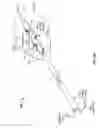 Fig. 99 - Catheter with a double balloon structure to generate and apply a heated ablative zone to tissue