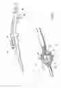Fig. 05 - SYSTEMS AND METHODS FOR TREATING TISSUE REGIONS OF THE BODY