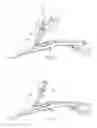 Fig. 11 - SYSTEMS AND METHODS FOR TREATING TISSUE REGIONS OF THE BODY