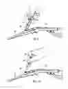 Fig. 12 - SYSTEMS AND METHODS FOR TREATING TISSUE REGIONS OF THE BODY