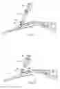 Fig. 13 - SYSTEMS AND METHODS FOR TREATING TISSUE REGIONS OF THE BODY