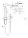 Fig. 02 - Irrigated multi-lumened electrophysiology catheter with fluid evacuation