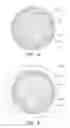 Fig. 04 - HUMAN IMPLANTABLE TISSUE EXPANDERS