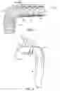 Fig. 02 - Aortic graft device
