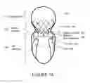 Fig. 02 - Heart valve prosthesis
