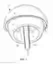 Fig. 02 - Veterinary hip resurfacing prosthetic system