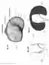 Fig. 22 - CRUCIATE RETAINING KNEE IMPLANTS AND METHODS FOR IMPLANTING CRUCIATE RETAINING KNEE IMPLANTS