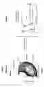 Fig. 35 - CRUCIATE RETAINING KNEE IMPLANTS AND METHODS FOR IMPLANTING CRUCIATE RETAINING KNEE IMPLANTS