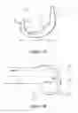 Fig. 02 - Instrumentation and methods for knee arthroplasty