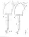 Fig. 08 - External steerable fiber for use in endoluminal deployment of expandable devices