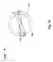 Fig. 15 - Methods for lenticular laser incision