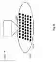 Fig. 16 - Methods for lenticular laser incision