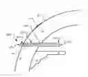 Fig. 01 - Glaucoma treatment devices and methods