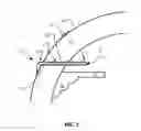 Fig. 02 - Glaucoma treatment devices and methods