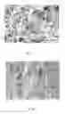 Fig. 06 - ABSORBENT PRODUCT COMPRISING A NONWOVEN MATERIAL