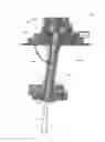 Fig. 01 - Devices and methods for percutaneous endoscopic gastronomy and other ostomy procedures