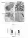 Fig. 08 - SMALL MOLECULE THERAPEUTIC COMPOUNDS TARGETING THIOESTERASE DEFICIENCY DISORDERS AND METHODS OF USING THE SAME