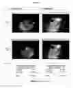 Fig. 09 - Method for reversing, preventing, delaying or stabilizing soft tissue calcification