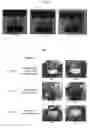 Fig. 06 - CRYSTAL FORMS OF APOMORPHINE AND USES THEREOF