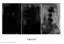 Fig. 28 - Compositions comprising acidic extracts of mastic gum