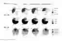 Fig. 24 - Biomarkers for predicting responsiveness to decitabine therapy