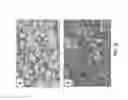 Fig. 07 - Human adenovirus serotype 5 vectors containing E1 and E2B deletions encoding the ebola virus glycoprotein