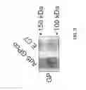 Fig. 10 - Human adenovirus serotype 5 vectors containing E1 and E2B deletions encoding the ebola virus glycoprotein