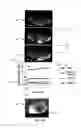 Fig. 04 - System and method for enhanced mass spectrometry imaging