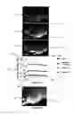 Fig. 05 - System and method for enhanced mass spectrometry imaging