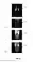 Fig. 12 - System and method for enhanced mass spectrometry imaging