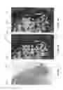 Fig. 16 - System and method for enhanced mass spectrometry imaging