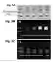 Fig. 07 - Curable composition and method for implantation