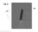 Fig. 08 - Curable composition and method for implantation