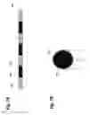 Fig. 09 - Curable composition and method for implantation