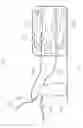 Fig. 02 - DEVICES FOR INFANT FEEDING