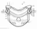 Fig. 01 - Adaptive buckling member in a patient interface