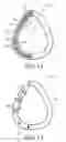Fig. 09 - Adaptive buckling member in a patient interface