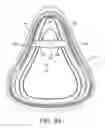 Fig. 06 - Adjustable tension device for CPAP mask