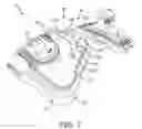 Fig. 09 - Adjustable tension device for CPAP mask