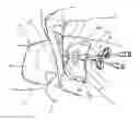 Fig. 01 - Wrap systems for medical device kits