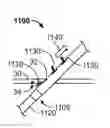Fig. 01 - Anchoring an intravenous cannula