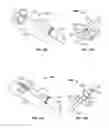 Fig. 09 - Anchoring an intravenous cannula