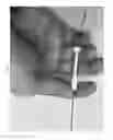 Fig. 07 - TORQUE DEVICES