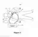 Fig. 02 - Electrode assembly having various communicative solutions
