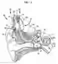 Fig. 02 - Surgical tool